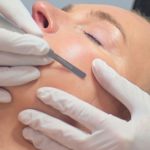 Therapist dermaplaning woman's face